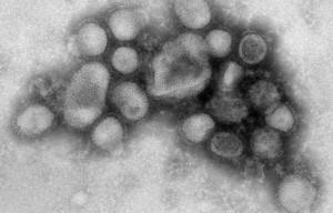 Third Flu Death Of Season Reported In SF